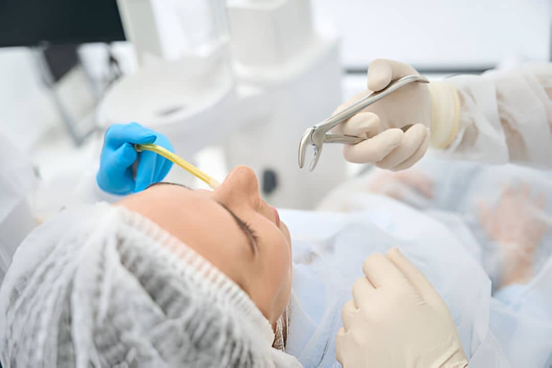 tooth extraction in vaughan