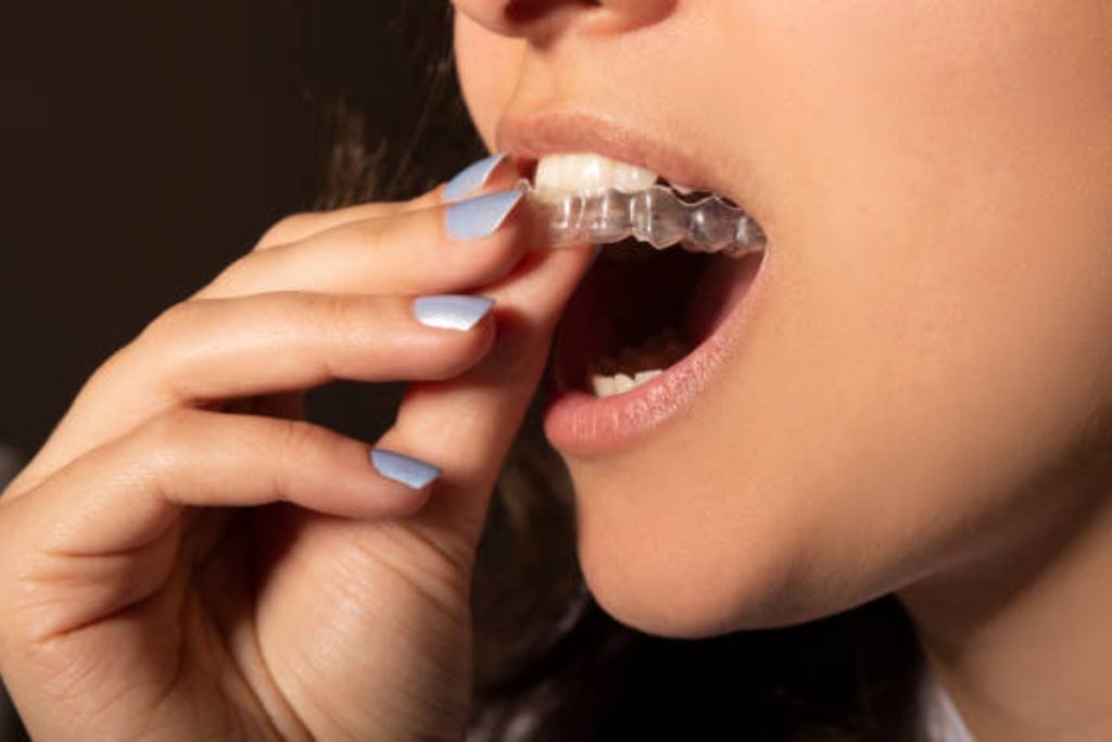 how Invisalign straightens teeth discreetly