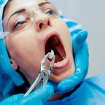 recover from wisdom teeth extraction