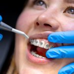 how orthodontics can omprove