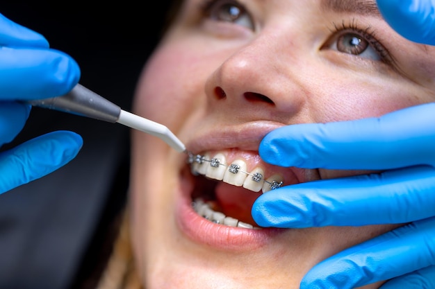 how orthodontics can omprove